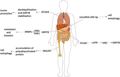 Targeting the GRP78 Pathway for Cancer Therapy